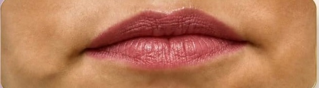 Lábios antes do preenchimento labial
